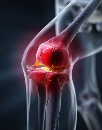Knee on Trac